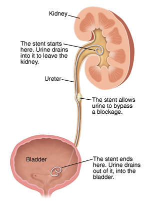 General Urology