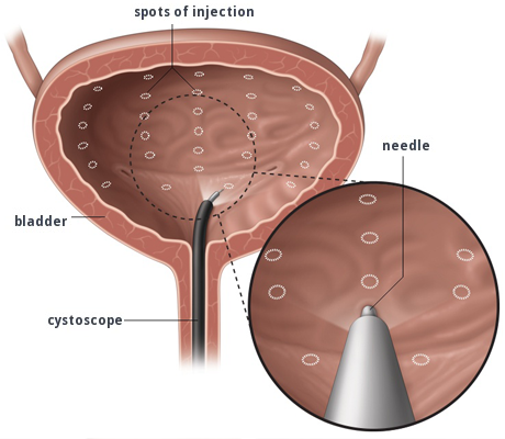 Female Urology Health Consulting